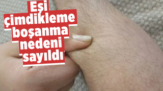 Eşi çimdikleme boşanma nedeni sayıldı