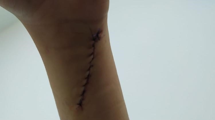 Evde dehşeti yaşadı; 70 dikiş atıldı