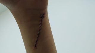 Evde dehşeti yaşadı; 70 dikiş atıldı