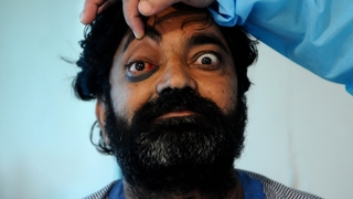 Eyvah; Kara mantar sınırımıza dayandı