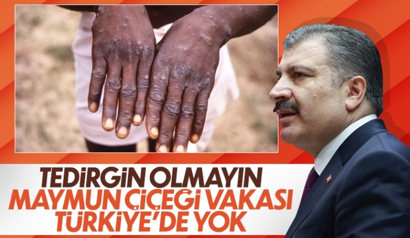 Fahrettin Koca: Maymun çiçeği tedirginlik oluşturmamalı