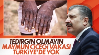 Fahrettin Koca: Maymun çiçeği tedirginlik oluşturmamalı