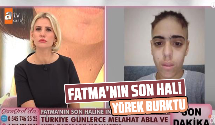 Fatma'nın son hali yürek burktu
