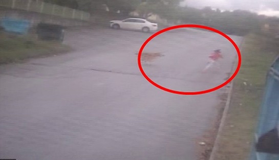 7 yaşındaki Eslem'e köpekler böyle saldırdı