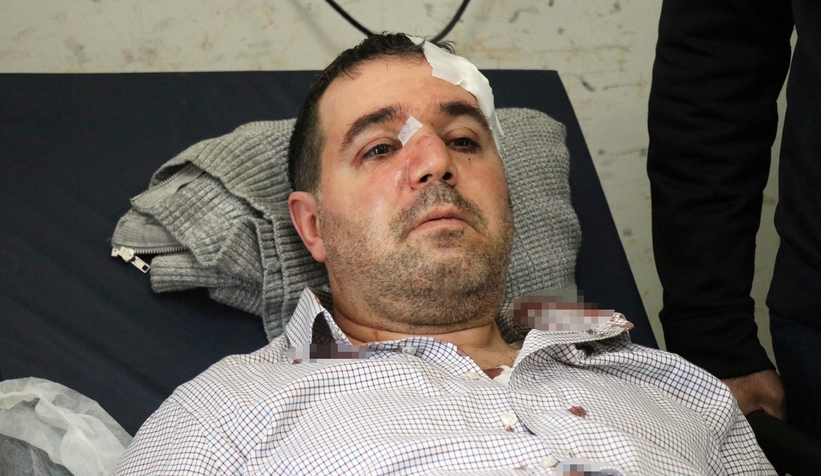 ‘Beni taciz, rahatsız ediyorsun’ diyerek saldırdığı aile hekiminin burnunu kırdı