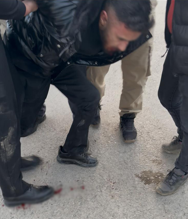 Akyazı’da dün akşam meydana gelen olay tartışma başlattı 