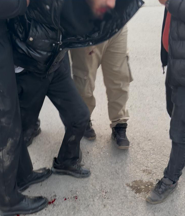 Akyazı’da dün akşam meydana gelen olay tartışma başlattı 