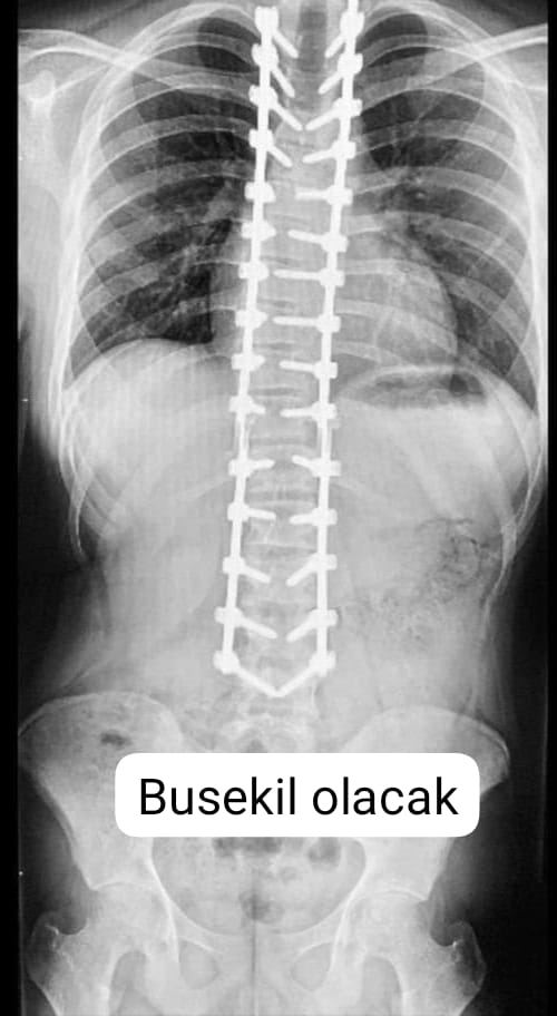 Ameliyat masrafları için yardım çağrısı