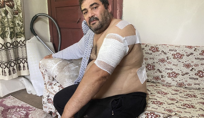 Ayı saldırısına uğrayan vatandaş: Beni öldü zannetti