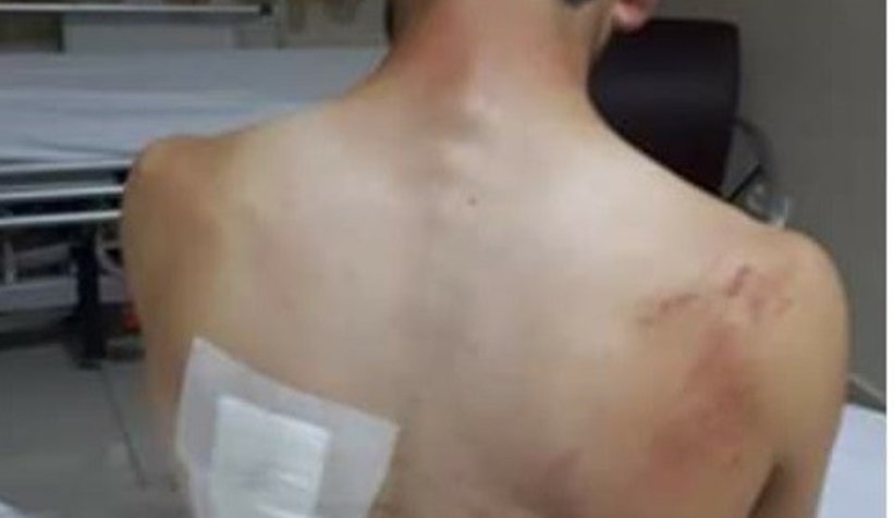 Ayının saldırısından köpekleri kurtardı