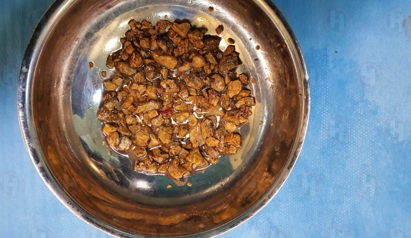 bobreginden-1200-den-fazla-tas-cikticutiounooe
