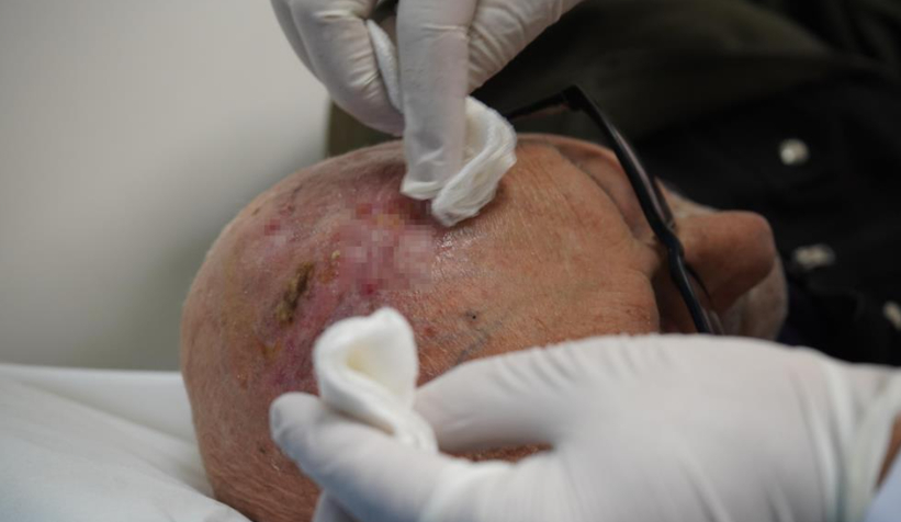 dunyada-ucuncu-kez-gorulen-nadir-tumor-tedavi-edildinzzqvghsct