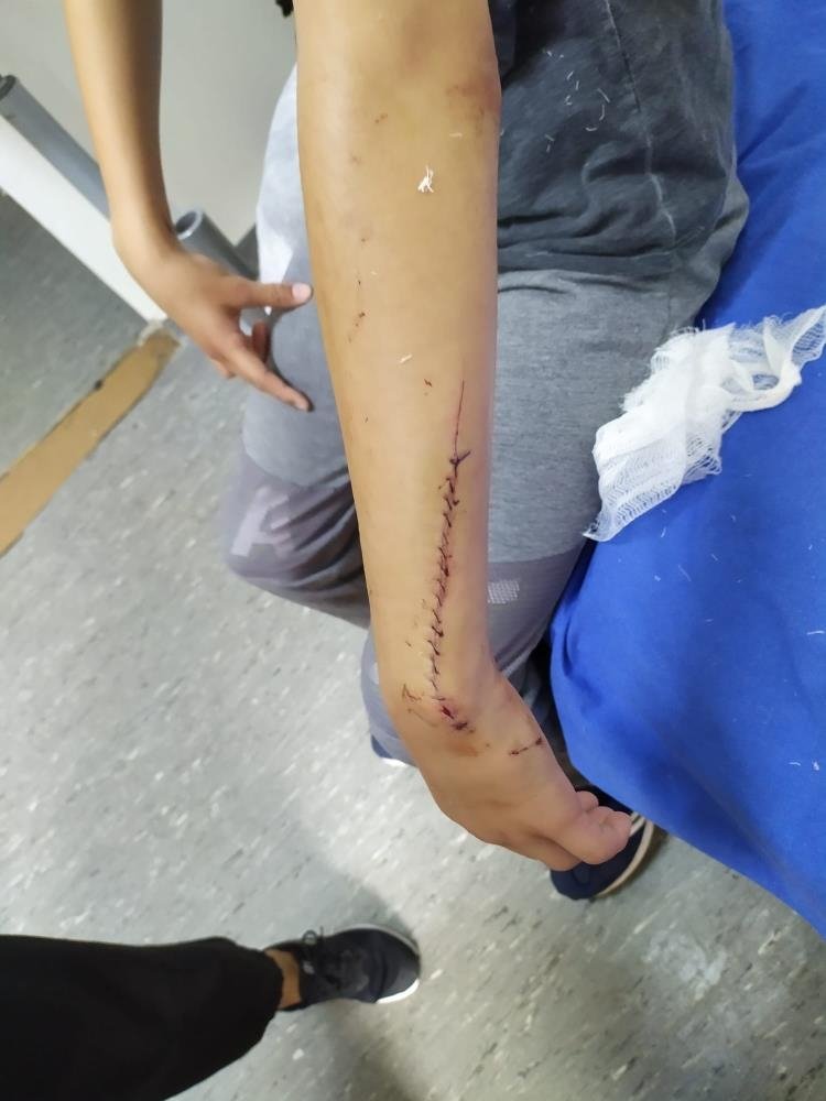 Evde dehşeti yaşadı; 70 dikiş atıldı