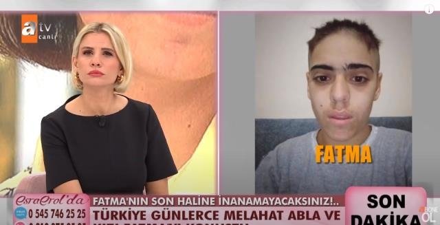 Fatma'nın son hali yürek burktu
