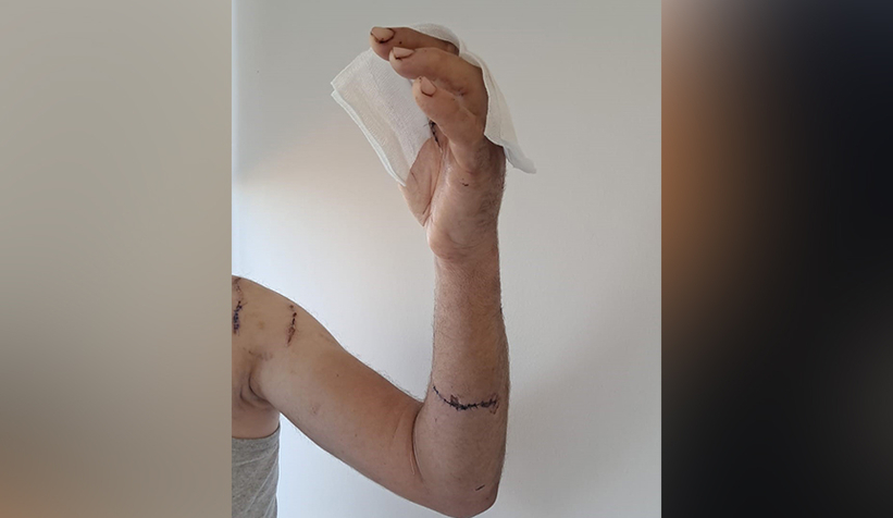 findik-bahcesinde-ayi-dehseti-parmagini-kaybettiqs9lt3ponk