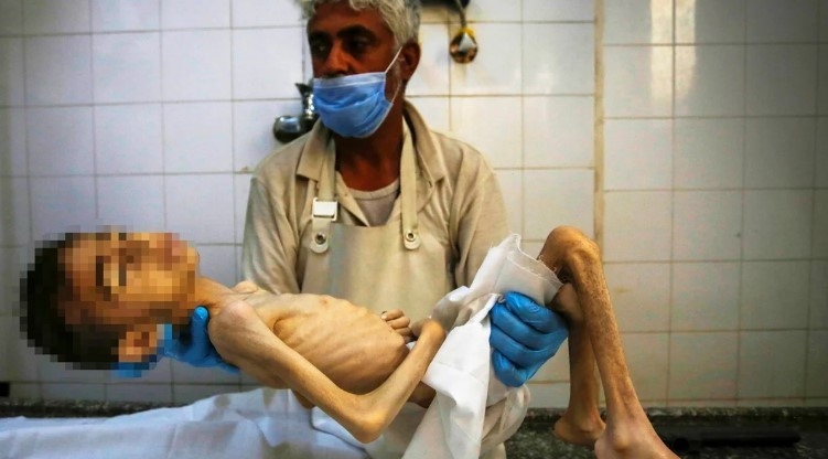 gazze-de-insanlik-ayibi-bir-cocuk-daha-acliktan-oldudgi3mg56sk