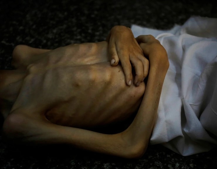gazze-de-insanlik-ayibi-bir-cocuk-daha-acliktan-oldudgi3mg56sk