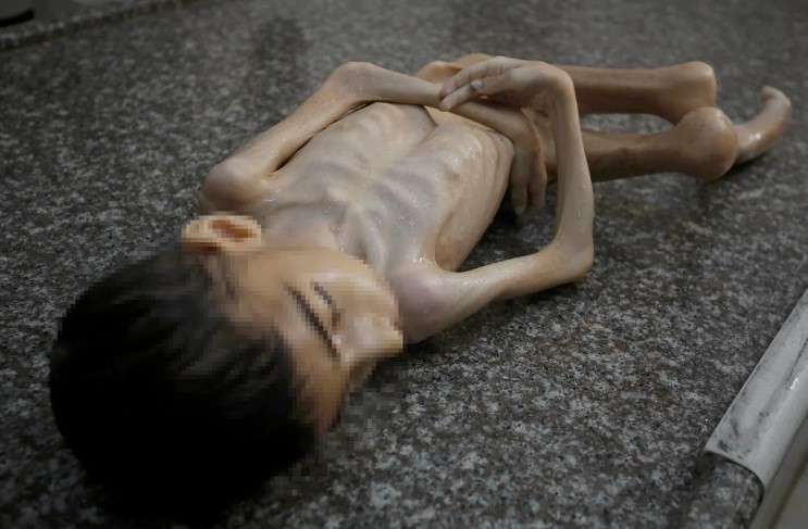 gazze-de-insanlik-ayibi-bir-cocuk-daha-acliktan-oldudgi3mg56sk