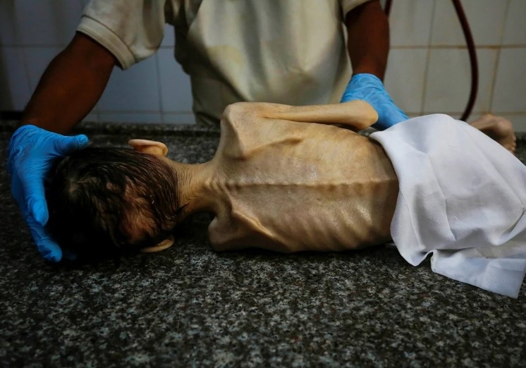 gazze-de-insanlik-ayibi-bir-cocuk-daha-acliktan-oldudgi3mg56sk