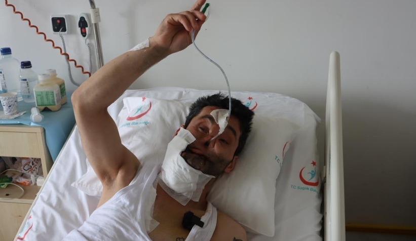 Gözlerini, çenesini ve burnunu kaybeden gencin hayali gerçek olacak