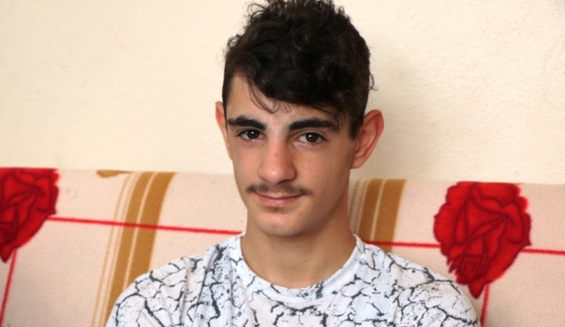 Hastalığı yüzünden güneşe çıkamıyor