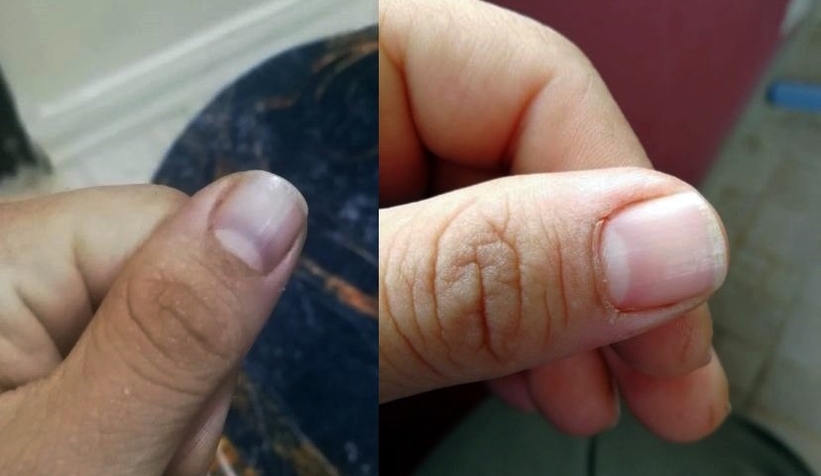 Hastalığına teşhis konamıyor