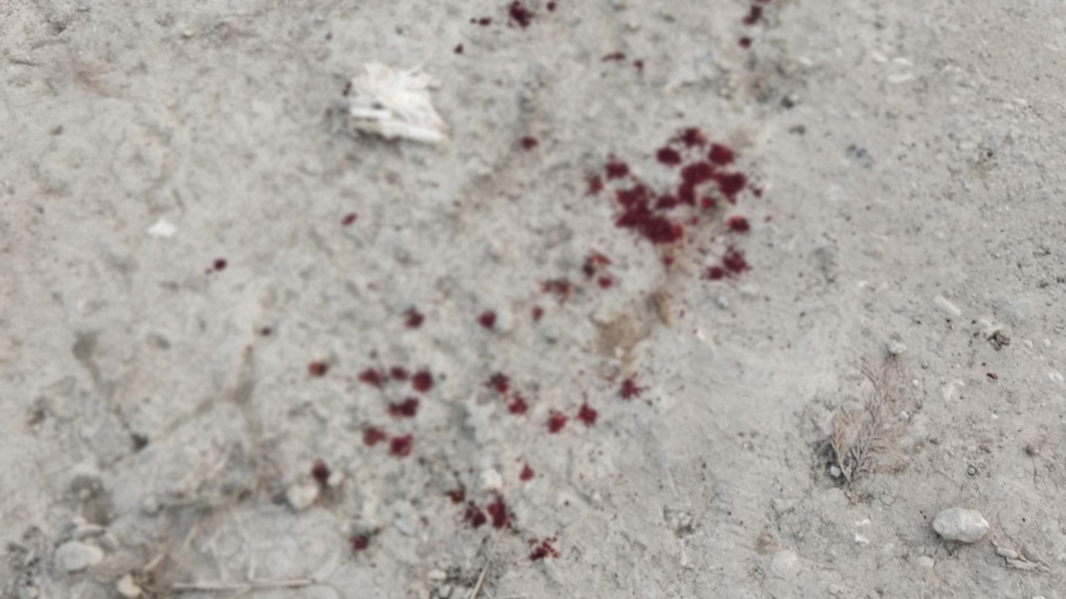 İftara yetişmek isterken düşüp hastanelik oldu