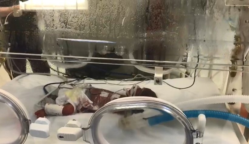 İki bebeğini kaybeden anne beşiz bebek dünyaya getirdi