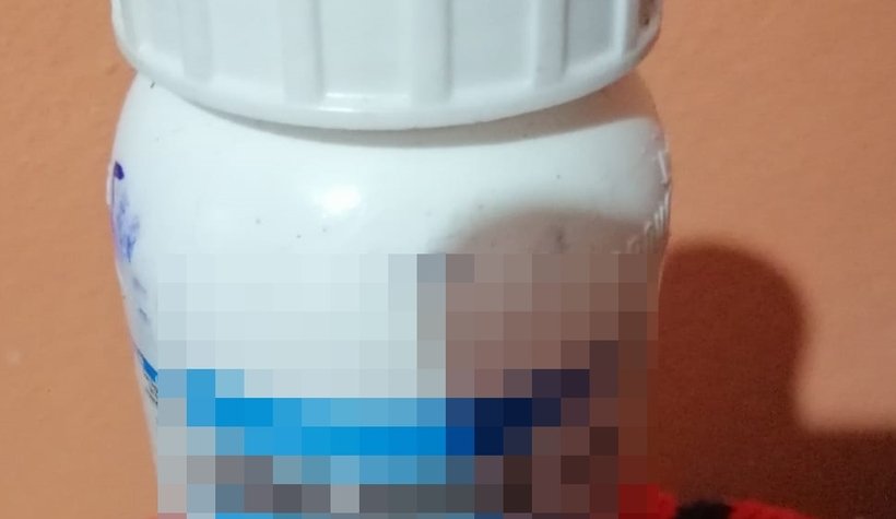 İlaçlama yaptı yüzü bu hale geldi