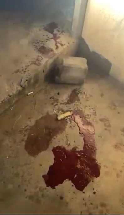 İşyerinde düşüp başını yardı