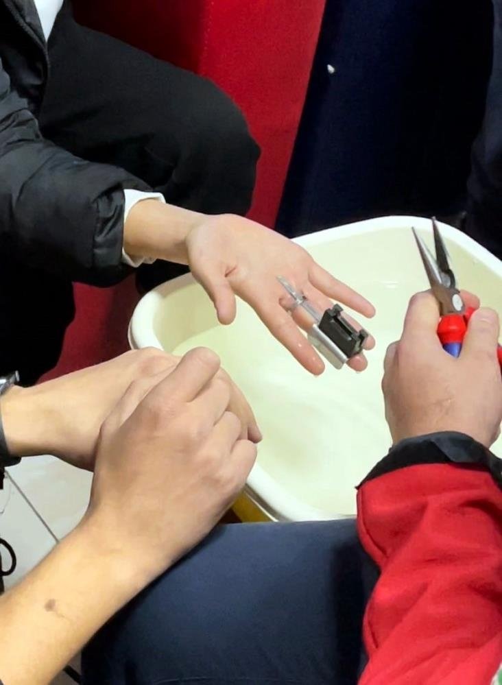 İtfaiyeden yüzük operasyonu