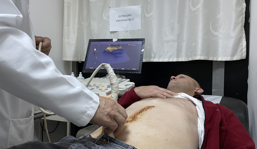 kanser hastası ilk kez yapılan ameliyatla sağlığına kavuştu