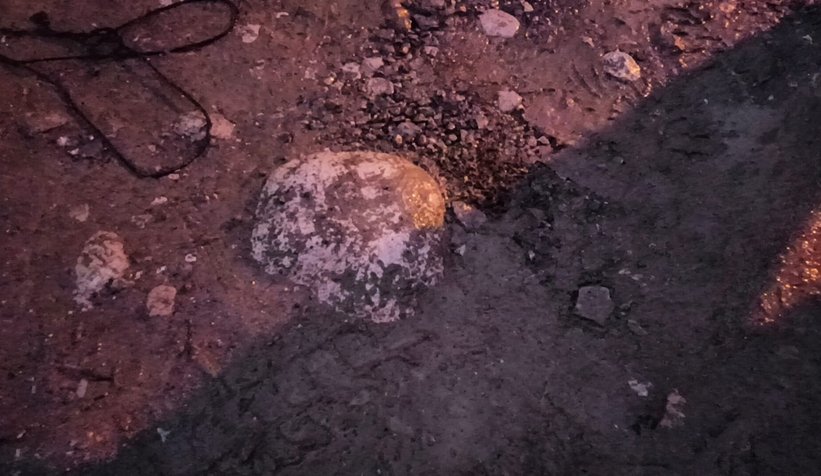 Kız çocuğu bozuk yolda düştü, dişleri kırıldı