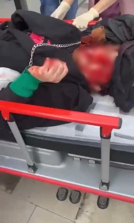 kocasi-sokak-ortasinda-bicaklamisti-goruntusu-ortaya-ciktir3j6ne1yod