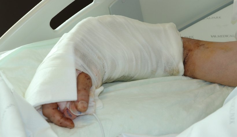 Kopan kolu yerine dikildi