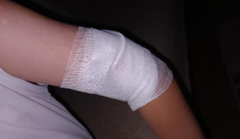 Kurt köpeğinin saldırdığı çocuk yaralandı