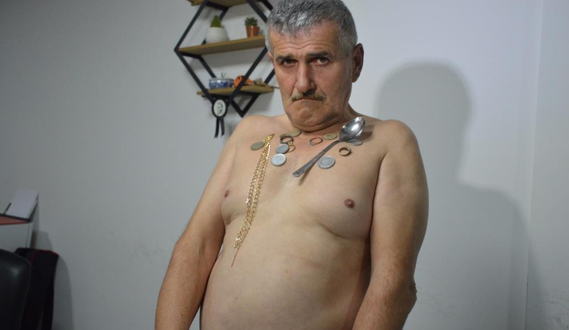 Mıknatıs Adam  hastaları tedavi ettiğini iddia etti