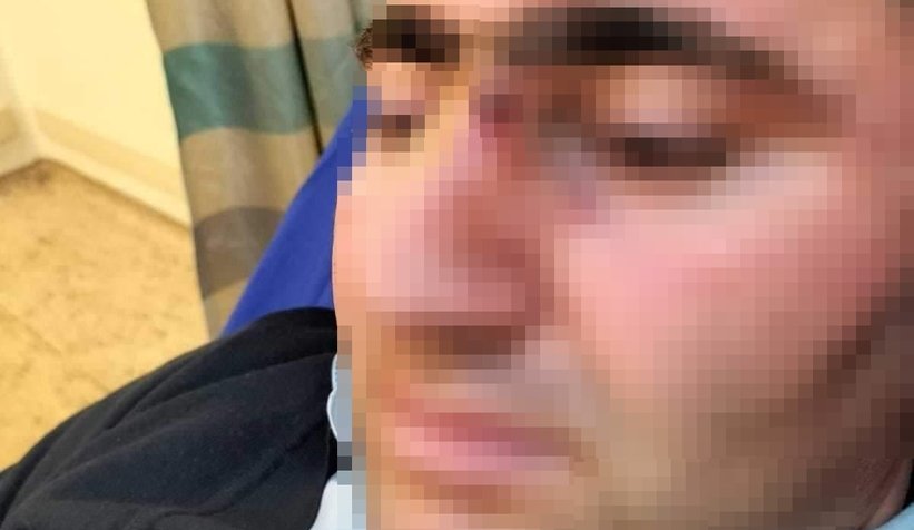 Muavinin burnunu kırdılar