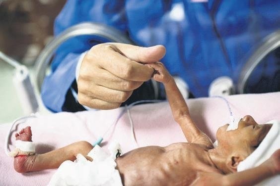 Mucize gerçekleşti, anne ve bebekleri kurtuldu