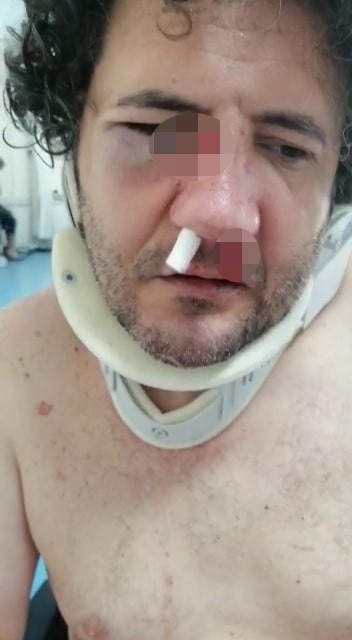 Nafaka yüzünden ölüm korkusuyla yaşıyor