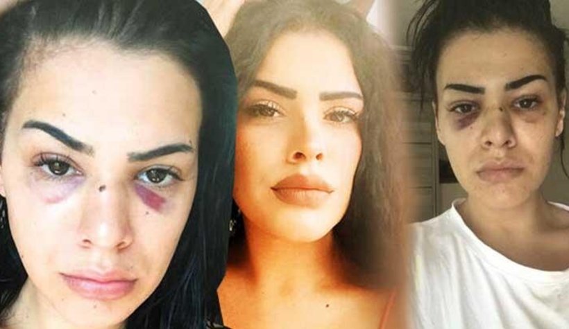 Nagehan'a dehşeti yaşatmışlardı serbestler