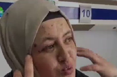 patlamada-yaralanan-sakaryali-aile-konustulza1k1ltuv