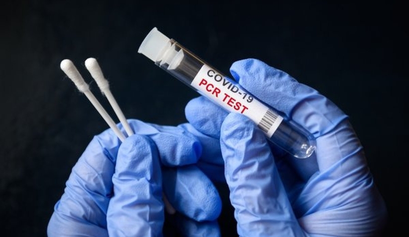pcr-testi-zorunlulugu-kalkti-mi-kimlere-yapilacak-bakan-koca-dan-flas-aciklamatlo2z0vgzt