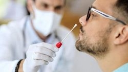 pcr-testi-zorunlulugu-kalkti-mi-kimlere-yapilacak-bakan-koca-dan-flas-aciklamatlo2z0vgzt