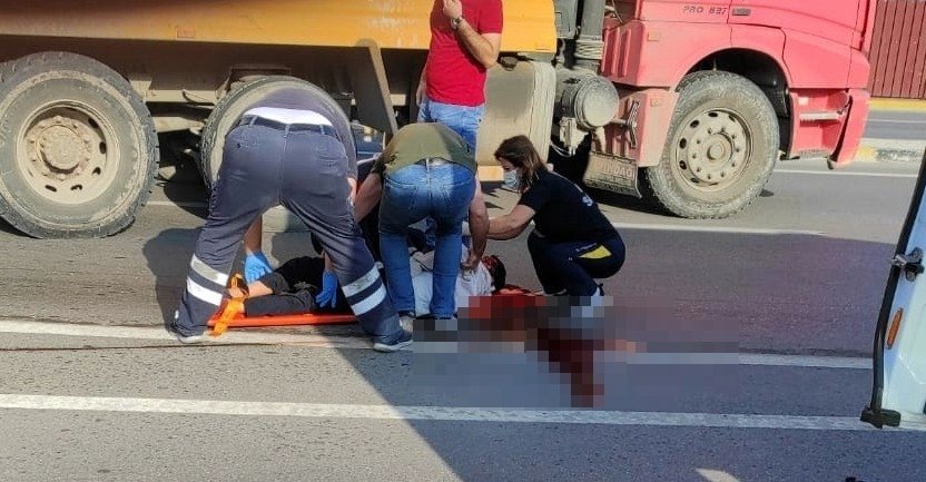 Polis aracının çarptığı çocuk öldü