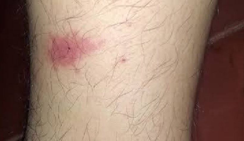 Sapanca'da Asya Kaplanı paniği