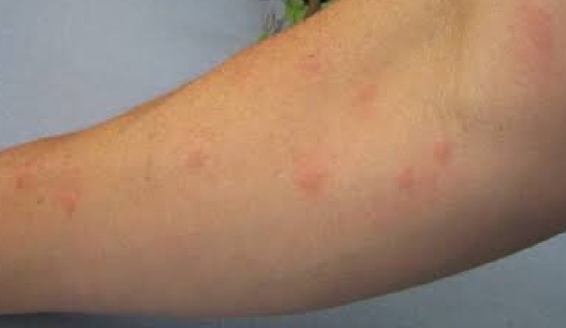 Sapanca'da Asya Kaplanı paniği