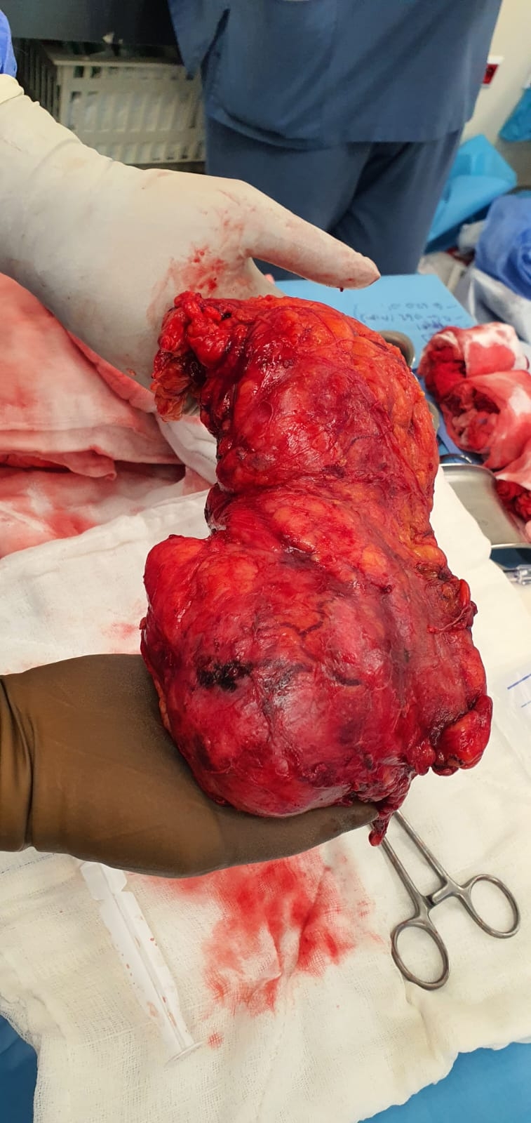 seahta-uroloji-kliniginden-bir-ilk-dahas1z1wfj2cl