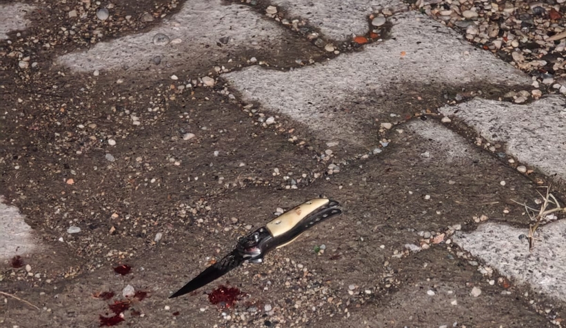 Gençler Arasında Sevgili Tartışması: Çakıyla Bacaklarından Yaraladı!