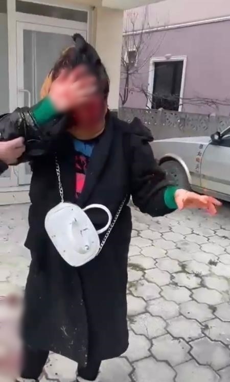 Sokak ortasındaki dehşete ilişkin saldırganın akrabası konuştu